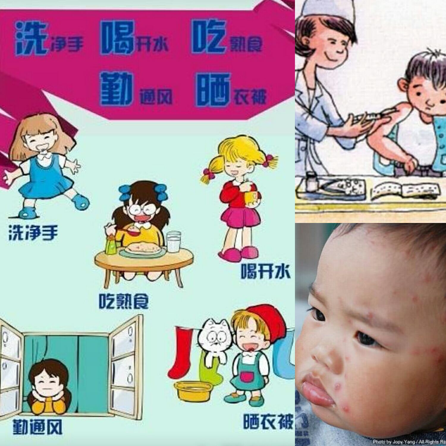 如何预防水痘的发生--南京市兴宁幼儿园